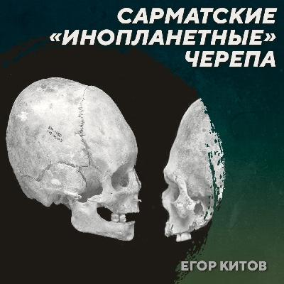 РС 426 Искусственная деформация черепов у сарматов. Егор Китов