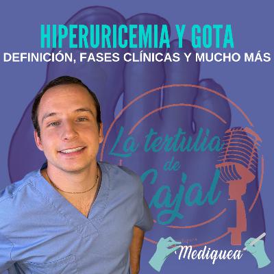 #41 Hiperuricemia y gota - Podcast MIR