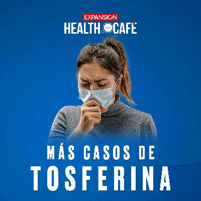 Brote de tosferina: cómo prevenirla y tratarla