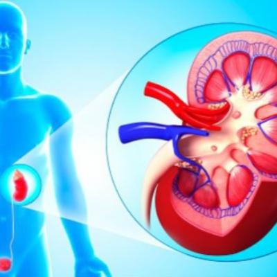 ENFERMEDAD DE LOS RIÑONES, FACTORES DE RIESGO, SÍNTOMAS Y PREVENCIÓN 👩⚕️ Aprende Fácil y sencillo sobre Salud y Medicina❤️ ENFERMEDAD DE LOS RIÑONES, FACTORES DE RIESGO, SÍNTOMAS Y PREVENCIÓN 👩⚕️ Aprende Fácil y sencillo sobre Salud y Medicina❤️