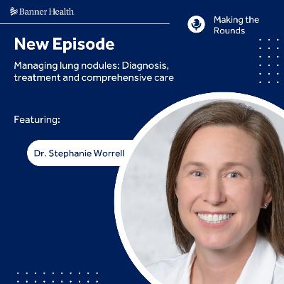 Managing lung nodules: Diagnosis, treatment and comprehensive care