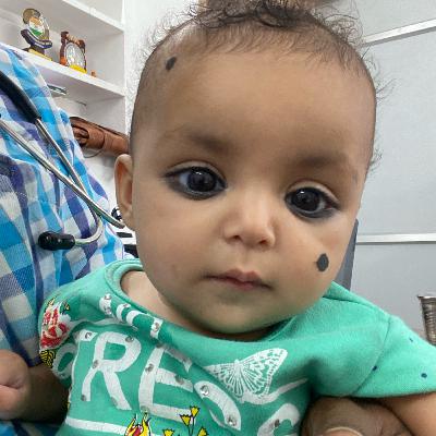 Febrile convulsions - அதீத காய்ச்சல் ஏற்ப்படுத்தும் வலிப்புகள்