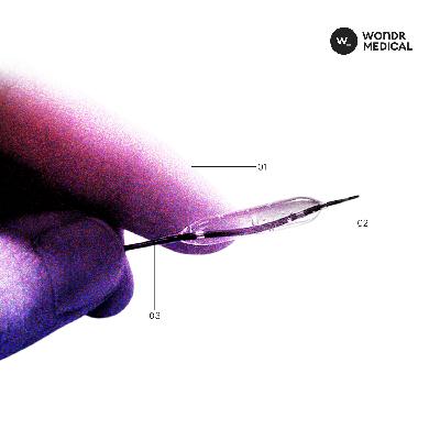 The Wonder of the Stent - Ulrich Sigwart and the Stent The Wonder of the Stent - Ulrich Sigwart and the Stent