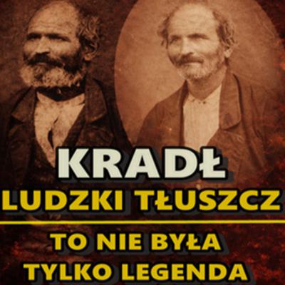 KRADŁ LUDZKI TŁUSZCZ. LEGENDA OKAZAŁA SIĘ PRAWDĄ? KRADŁ LUDZKI TŁUSZCZ. LEGENDA OKAZAŁA SIĘ PRAWDĄ?
