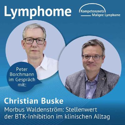 Morbus Waldenström: Stellenwert der BTK-Inhibition im klinischen Alltag Morbus Waldenström: Stellenwert der BTK-Inhibition im klinischen Alltag