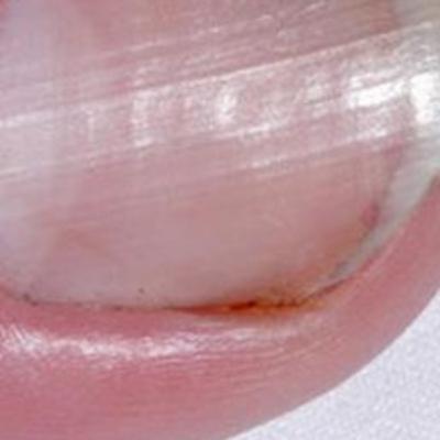 Ngobrol Asik Fenomena Cantengan #NGOBRAS