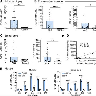 FGF21 Muscle Hormone Associated with Slow ALS Progression and Extended Survival