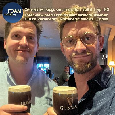 Semester opg. om traction splint | ep. 80