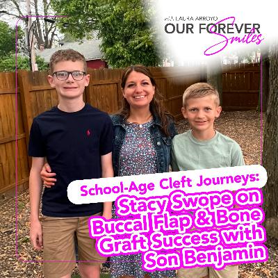 School-Age Cleft Journeys: Stacy Swope on Buccal Flap & Bone Graft Success with Son Benjamin School-Age Cleft Journeys: Stacy Swope on Buccal Flap & Bone Graft Success with Son Benjamin
