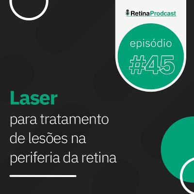 Live #46: Laser para tratamento de lesões na periferia da retina Live #46: Laser para tratamento de lesões na periferia da retina