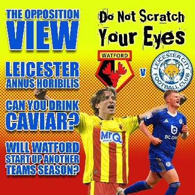 OPPOSITION VIEW - LEICESTER CITY OPPOSITION VIEW - LEICESTER CITY