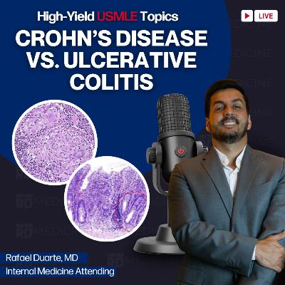 Crohn’s Disease vs. Ulcerative Colitis: High-Yield USMLE Topics You Must Know!