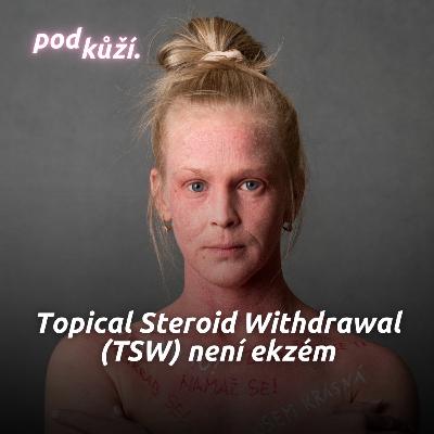 Janča: Topical Steroid Withdrawal (TSW) není ekzém. Přála bych si, aby to lékaři pochopili Janča: Topical Steroid Withdrawal (TSW) není ekzém. Přála bych si, aby to lékaři pochopili