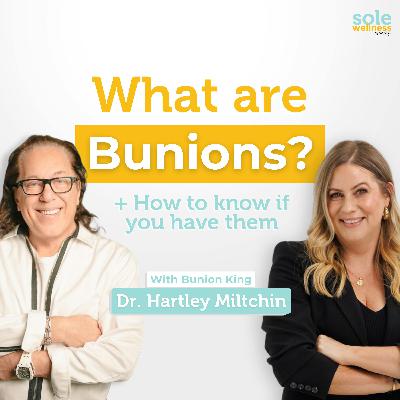 What are Bunions? + How to know if you have them with Dr. Hartley Miltchin