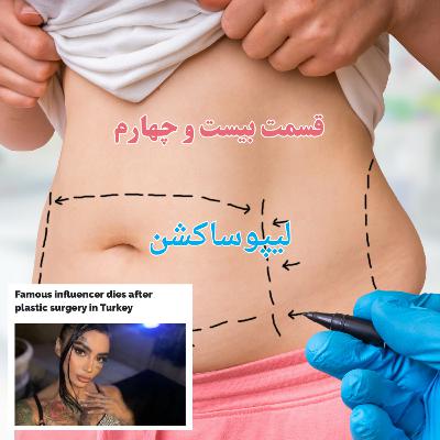 EP24 - لیپوساکشن