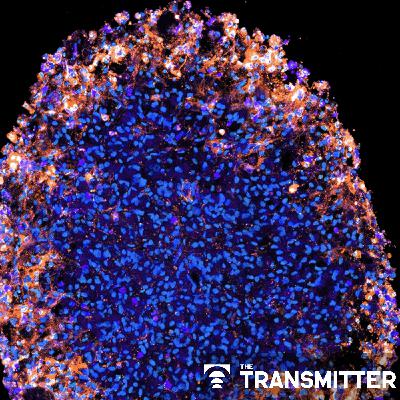 What is the future of organoid and assembloid regulation? What is the future of organoid and assembloid regulation?