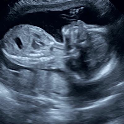 273: Our Miracle Baby!