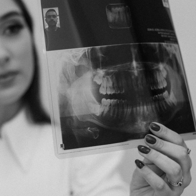The OPTISMILE Podcast 114 - How to Read Your Own X-Rays (Co-Discovery)