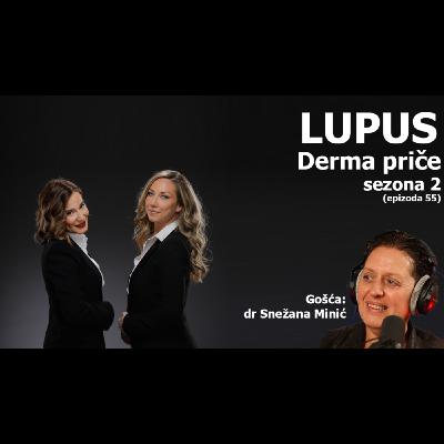 55 - Lupus 55 - Lupus