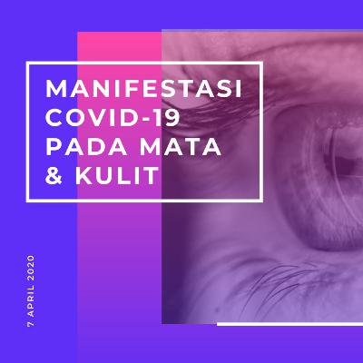 Manifestasi COVID-19 Pada Mata & Kulit Manifestasi COVID-19 Pada Mata & Kulit