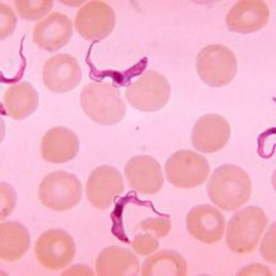 Did Someone say Sleeping Sickness?