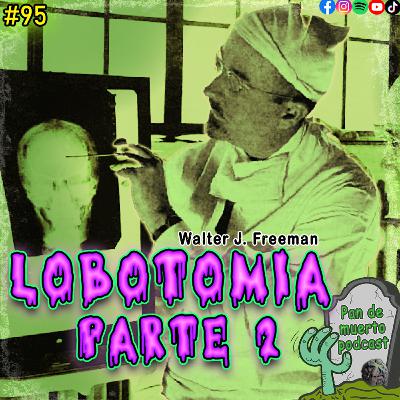96. Lobotomia en Estados Unidos, la historia de Walter Jackson Freeman