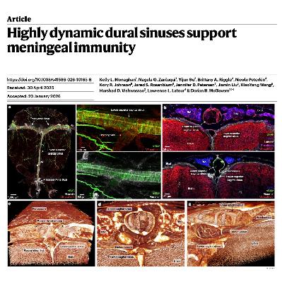 604-Dynamic Dural Sinuses: Gatekeepers of Meningeal Immunity