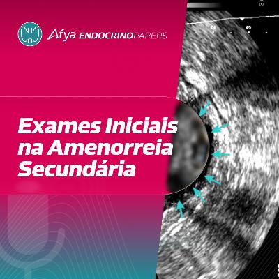 Quais exames devem ser solicitados inicialmente para uma paciente com amenorreia secundária? Quais exames devem ser solicitados inicialmente para uma paciente com amenorreia secundária?