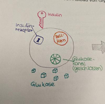 Diabetes und Insulin