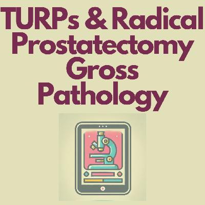 TURPs and Radical Prostatectomy - Prostate Anatomy and Gross Pathology