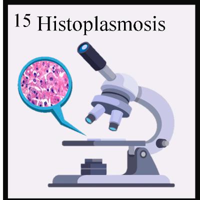 15. Histoplasmosis