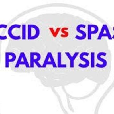 Flaccidity vs Spasticity: Where are these from?