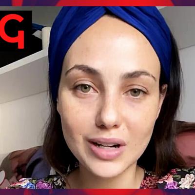 “Ho un livido enorme…” Rosalinda Cannavò confessa di non stare molto bene