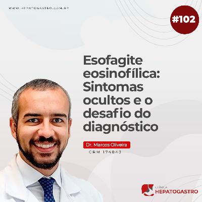 #102 - Esofagite eosinofílica: Sintomas ocultos e o desafio do diagnóstico