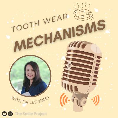 Tooth Wear Mechanisms (Part 1)