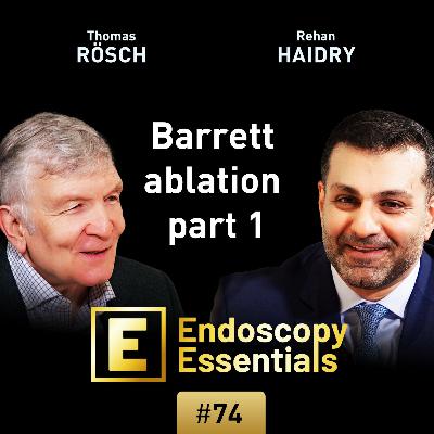 Barrett ablation: Indications and techniques