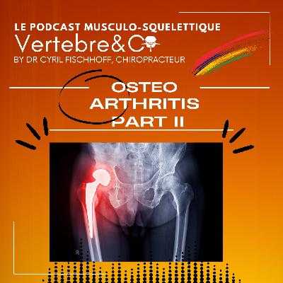 Osteo-Arthritis Part II Osteo-Arthritis Part II