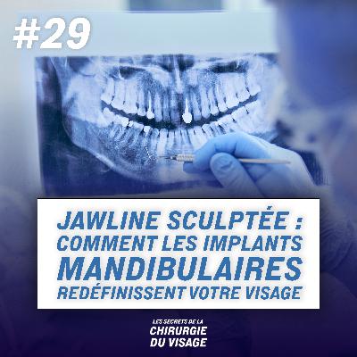 #29 - JAWLINE SCULPTÉE : COMMENT LES IMPLANTS MANDIBULAIRES REDÉFINISSENT VOTRE VISAGE