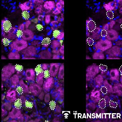 Neurons tune electron transport chain to survive onslaught of noxious stimuli Neurons tune electron transport chain to survive onslaught of noxious stimuli