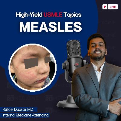 Measles: High-Yield USMLE Topics You Must Know