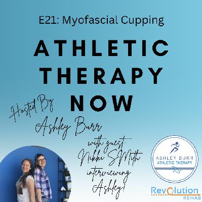 E21 with Ashley Burr CAT(C) & Nikki Smith CAT(C) - Myofascial Cupping