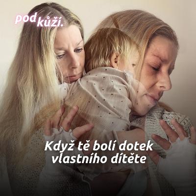 Jana: Když jsem měla ekzém, nechtěla jsem se dotknout svého dítěte Jana: Když jsem měla ekzém, nechtěla jsem se dotknout svého dítěte