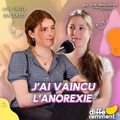 #17 La vérité sur l’anorexie et comment trouver un rapport sain à la nourriture