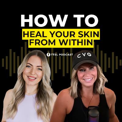 S12 EP27: How to Heal Your Skin from Within