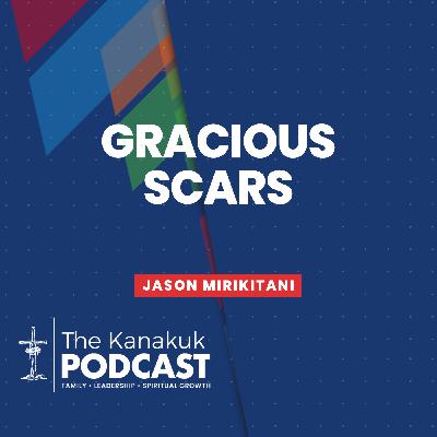 Gracious Scars Gracious Scars