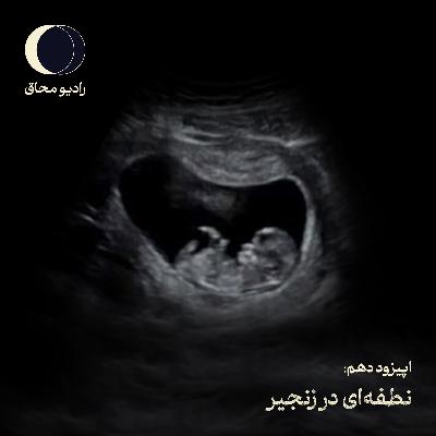 اپیزود دهم: نطفه ای در زنجیر