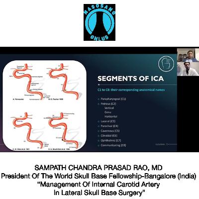 Management Of Internal Carotid Artery In Lateral Skull Base Surgery