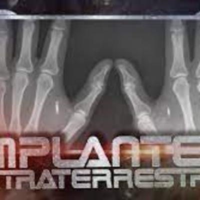 Implantes puestos en vida extraterrestre del consultante le creaban vacío existencial en esta vida.
