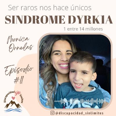 11. Monica Ornelas Sindrome Dyrk1A
