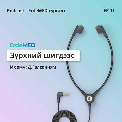 Зүрхний шигдээс